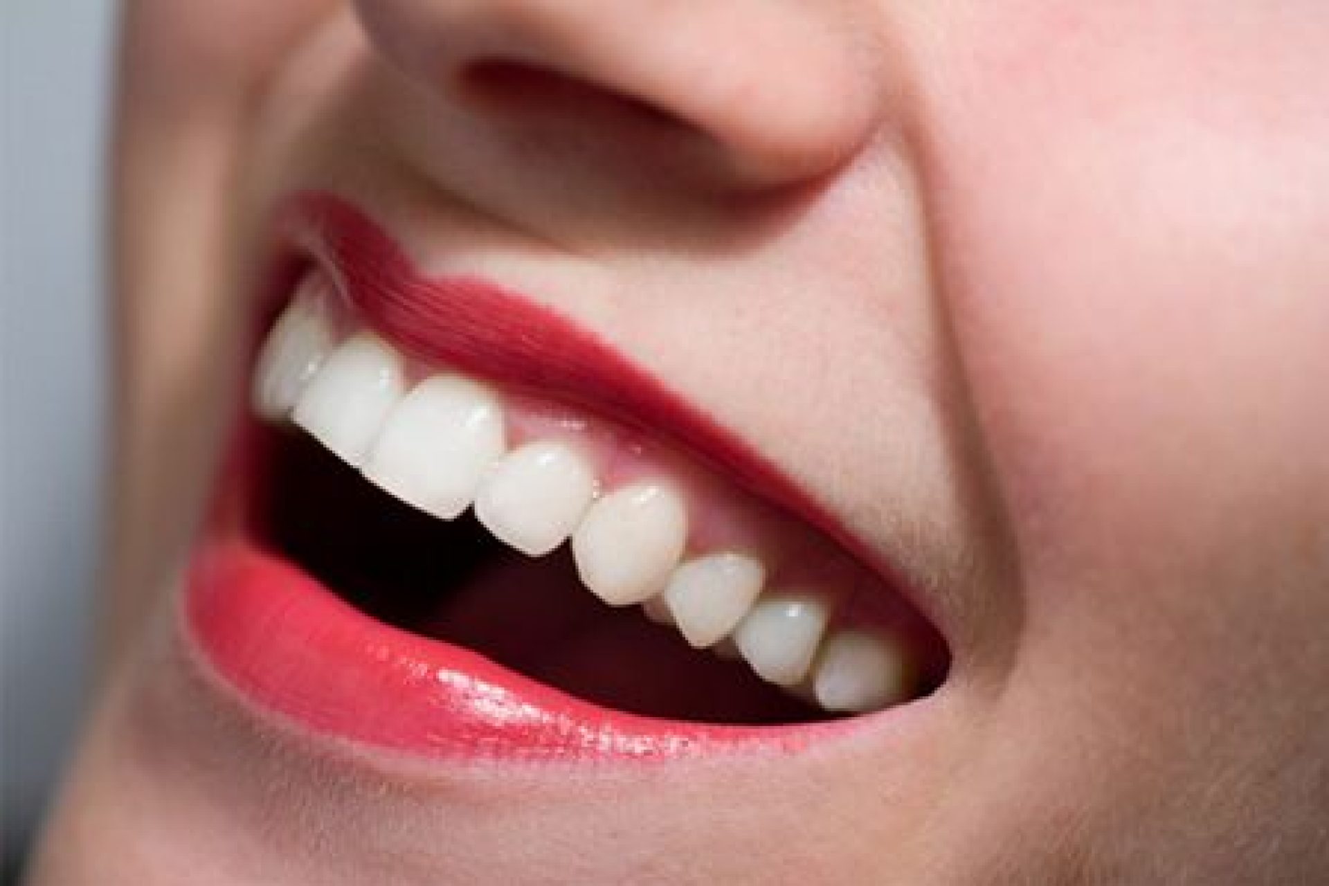 teeth whitening in gaur city by best dentist near you